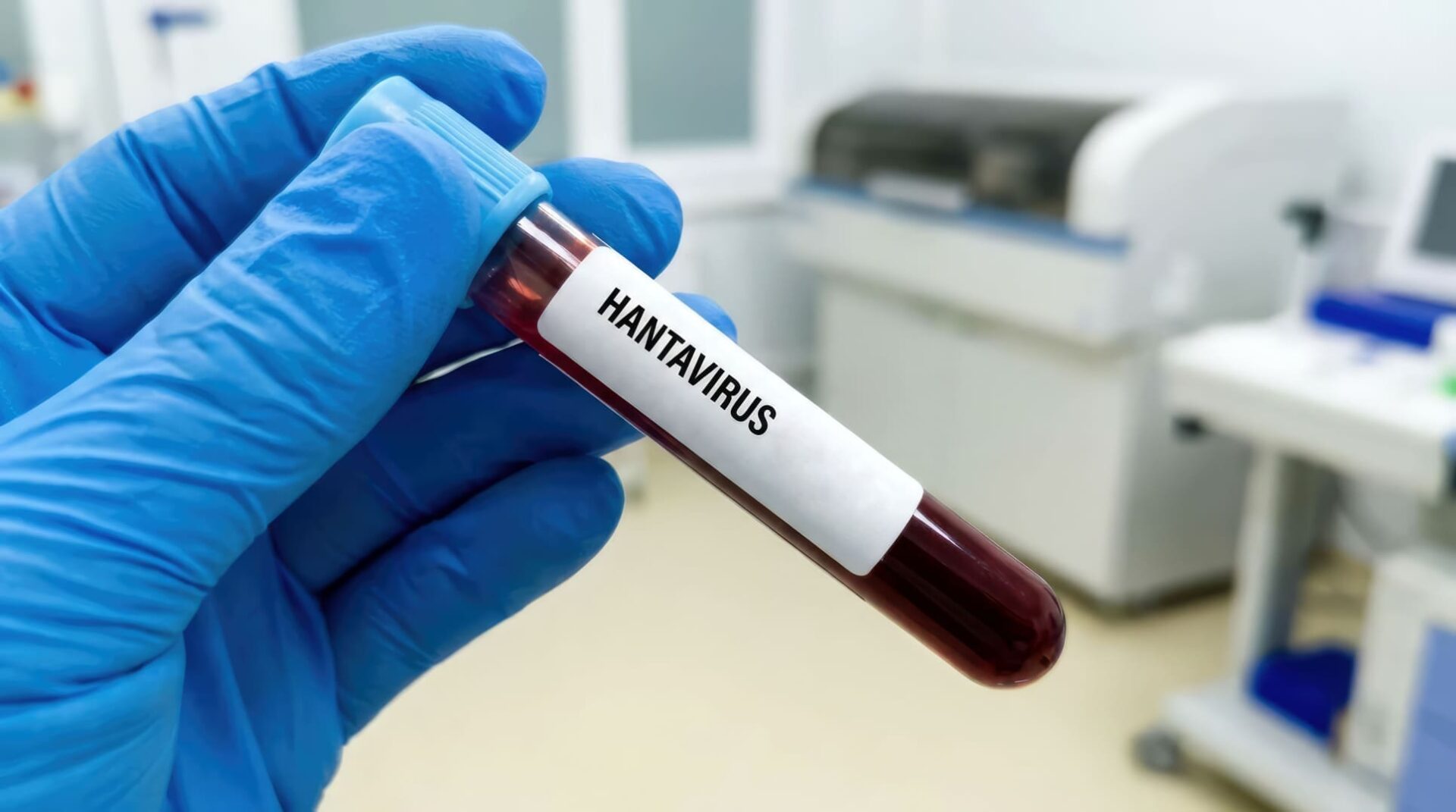 El hantavirus: ¿una nueva amenaza para la economía global?