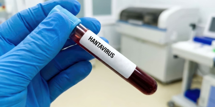 El hantavirus: ¿una nueva amenaza para la economía global?